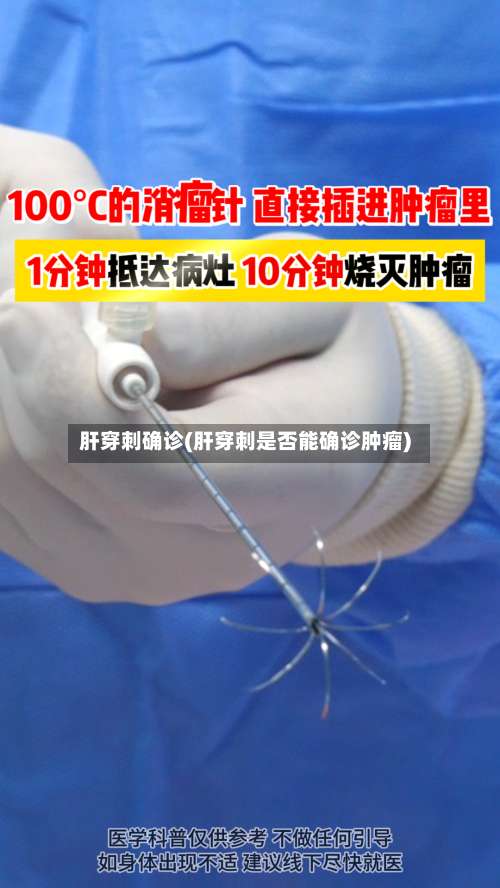 肝穿刺确诊(肝穿刺是否能确诊肿瘤)