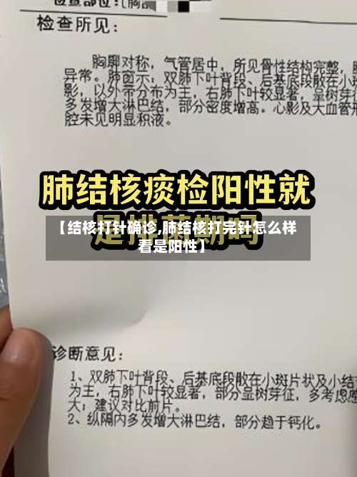 【结核打针确诊,肺结核打完针怎么样看是阳性】-第3张图片