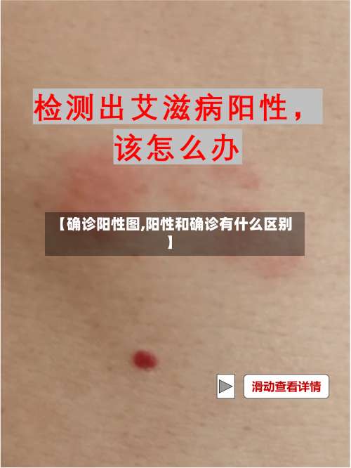 【确诊阳性图,阳性和确诊有什么区别】