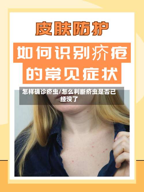怎样确诊疥虫/怎么判断疥虫是否已经没了-第2张图片