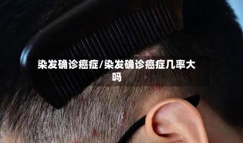 染发确诊癌症/染发确诊癌症几率大吗