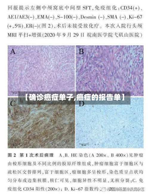 【确诊癌症单子,癌症的报告单】-第3张图片