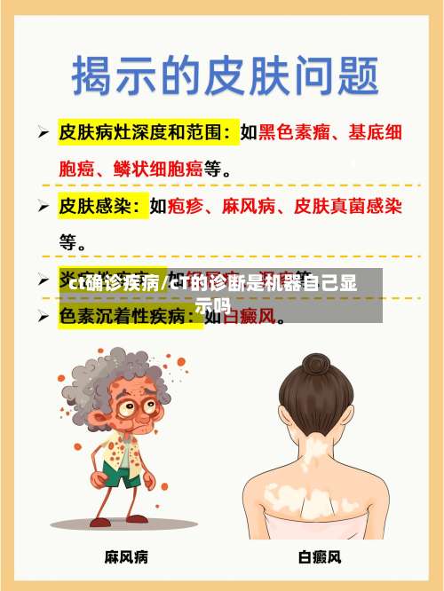 ct确诊疾病/cT的诊断是机器自己显示吗-第2张图片