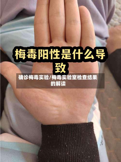 确诊梅毒实验/梅毒实验室检查结果的解读