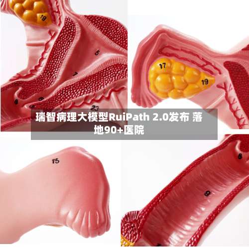 瑞智病理大模型RuiPath 2.0发布 落地90+医院