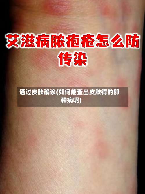 通过皮肤确诊(如何能查出皮肤得的那种病呢)