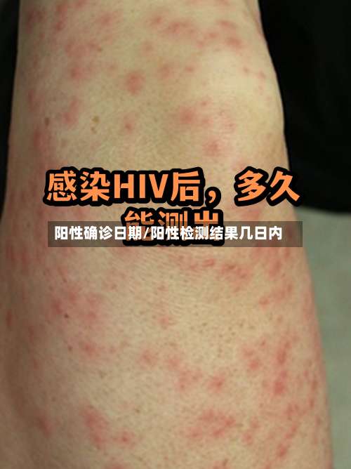 阳性确诊日期/阳性检测结果几日内-第2张图片