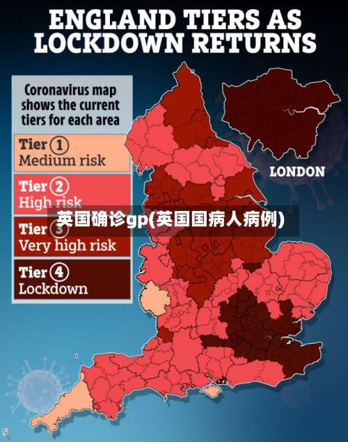 英国确诊gp(英国国病人病例)-第2张图片