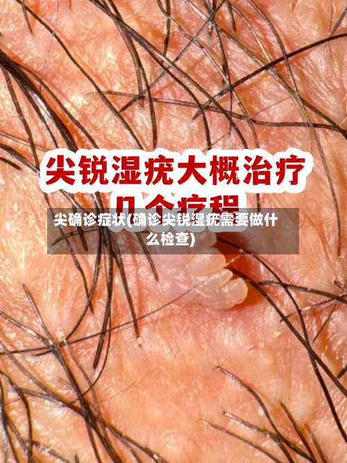 尖确诊症状(确诊尖锐湿疣需要做什么检查)