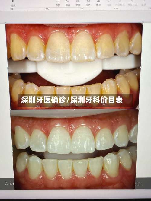 深圳牙医确诊/深圳牙科价目表