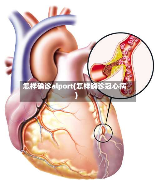 怎样确诊alport(怎样确诊冠心病)-第2张图片