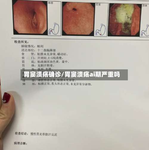 胃窦溃疡确诊/胃窦溃疡ai期严重吗