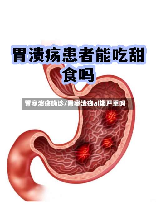 胃窦溃疡确诊/胃窦溃疡ai期严重吗-第2张图片