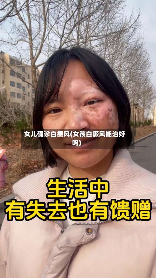 女儿确诊白癜风(女孩白癜风能治好吗)