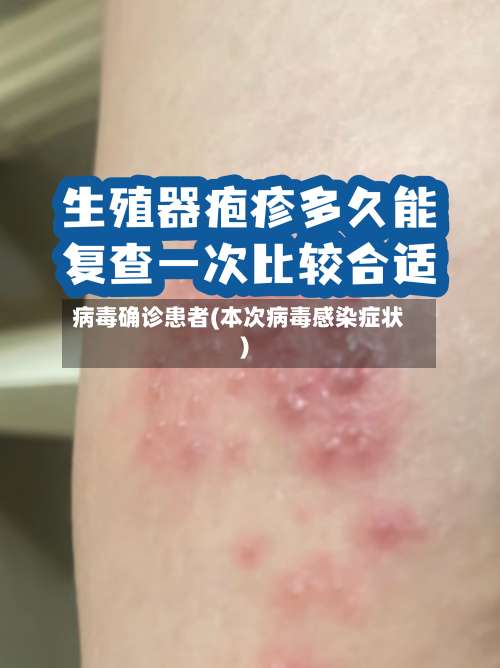 病毒确诊患者(本次病毒感染症状)