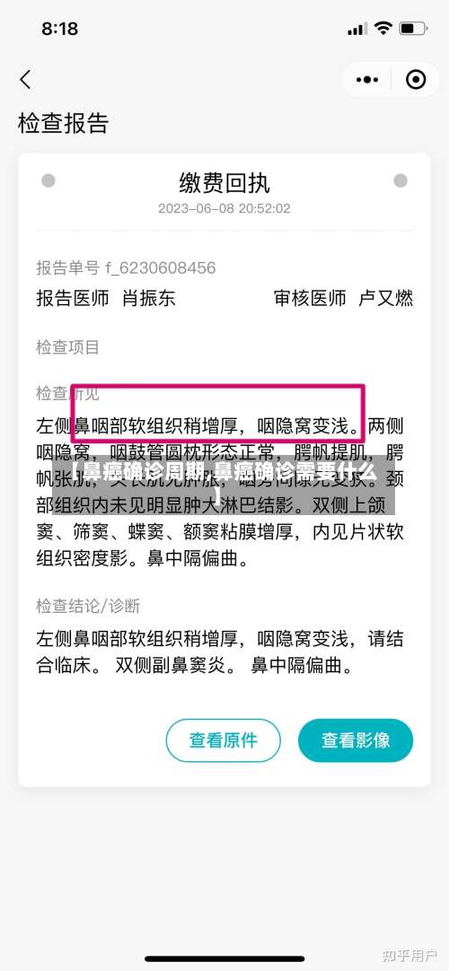 【鼻癌确诊周期,鼻癌确诊需要什么】-第2张图片