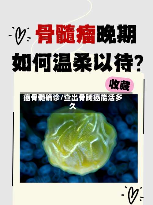 癌骨髓确诊/查出骨髓癌能活多久-第2张图片